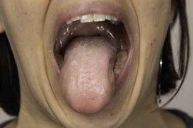 Dilini gösteren ağzı açık bir kadın.