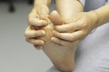 Kafkasyalı bir kadının ayağının altında, ayak parmaklarını ayırarak ayak ağrısına, kiropoduna ve eklem iltihabına daha yakından bakmak için yakın çekim görüntüsü..