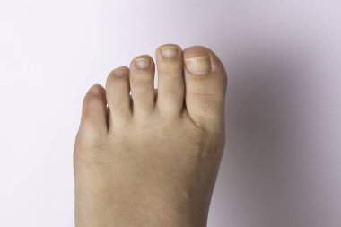 Ayak parmaklarına yakın, kadının parmakları izole.