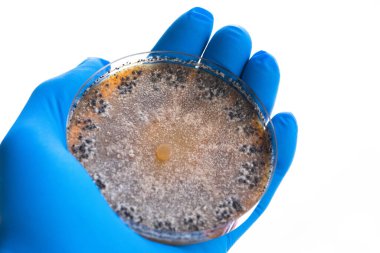 Doktorun elindeki laboratuvar örneği.