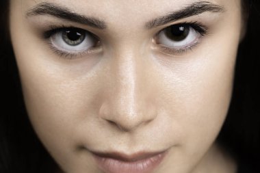 Gözlerinde Heterokromi iridum olan bir kızın yüzüne.