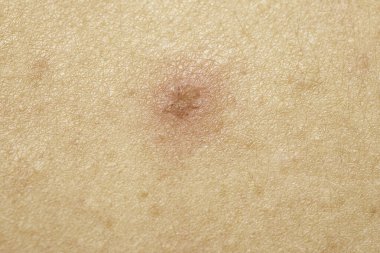 Deride kabuk, yakından.