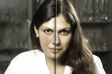 A before and after portrait of a professional woman who suffered from rosacea, resulting in rosy red cheeks, laser surgery gives a flawless complexion with confident smile. clipart