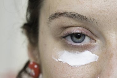 Gözün altındaki hassas cilde sürülen beyaz kremle, yirmili yaşlarının ortasında bir kızın yüzünde şişkinlik ve yorgunluğu tedavi etmek için kullanılan aşırı yakın çekim görüntüsü..