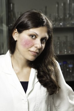 İşteki genç ve güzel bir laboratuvar teknisyeninin portresi beyaz bir laboratuvar önlüğü giyiyor, parlak kırmızı yanaklardan muzdarip, genişlemiş kan damarları, kendinden emin..