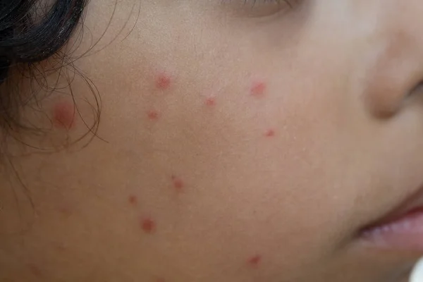 Fotosuratlarda ayollar oz shakllarini korsatadilar