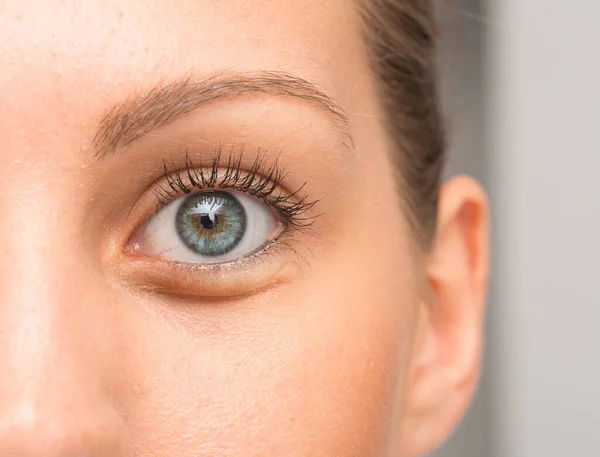 Beyaz Bir Kadının Göz Kapağının Altındaki Göz Torbaları — Stok fotoğraf