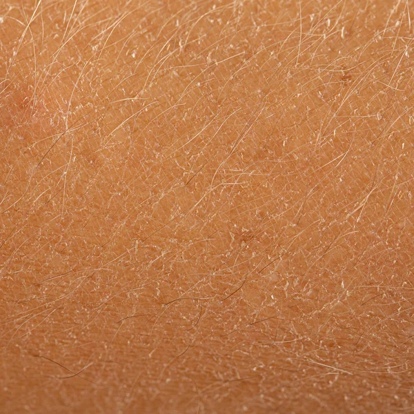 細かい毛は白人の肌にマクロなディティールで見られる 水分を必要とする乾燥し かすかな人間の皮膚 — ストック写真
