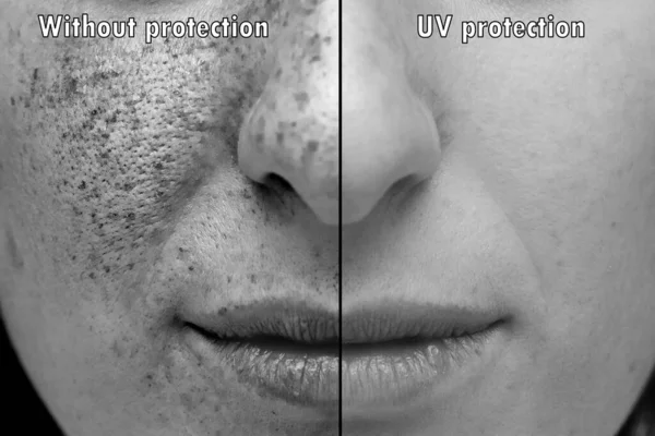 Ultraviolette Fotografie Des Gesichts Das Den Sonnenstrahlen Ausgesetzt Ist — Stockfoto