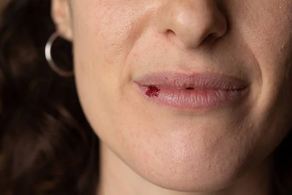 Detalhe Rosto Uma Menina Com Uma Mancha Batom Lábio Inferior — Fotografia de Stock