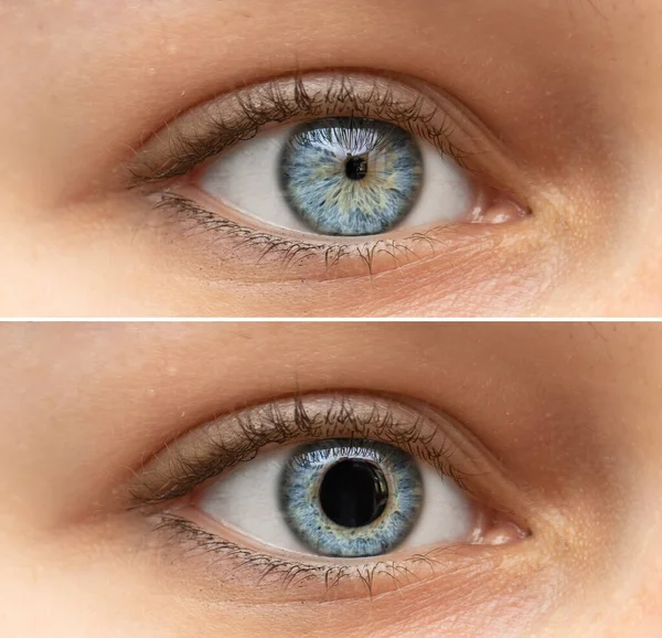 Closeup View Blue Eyes Pretty Young Woman Collage Comparing Black — Stock Photo, Image