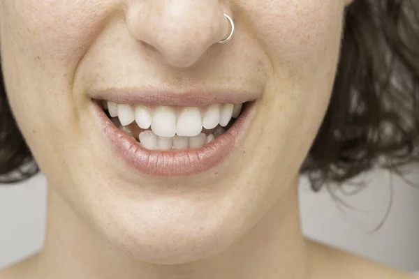 Detalhes Dos Dentes Uma Rapariga Imagem Conceptual Bruxismo Sintoma — Fotografia de Stock