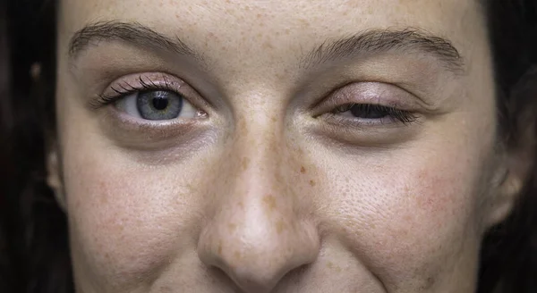 Primer Plano Ojos Azules Cara Chica Con Ojo Medio Cerrado —  Fotos de Stock