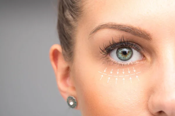Kadın yüzünde Blepharoplasty