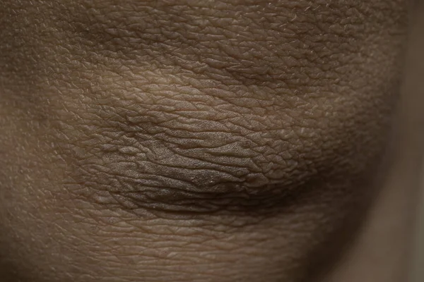 Emberi Testrész Bőr Közelről — Stock Fotó