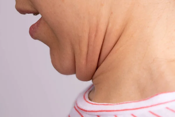 Close Side Profile View Young Caucasian Woman Pushing Her Chin — Stock Photo, Image