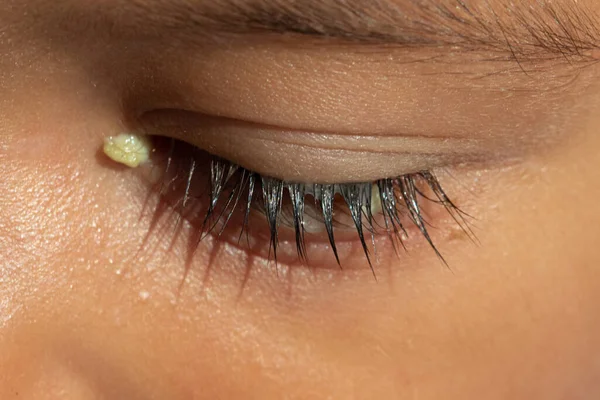 Das Auge Eines Armen Jungen Wird Aus Der Nähe Betrachtet — Stockfoto