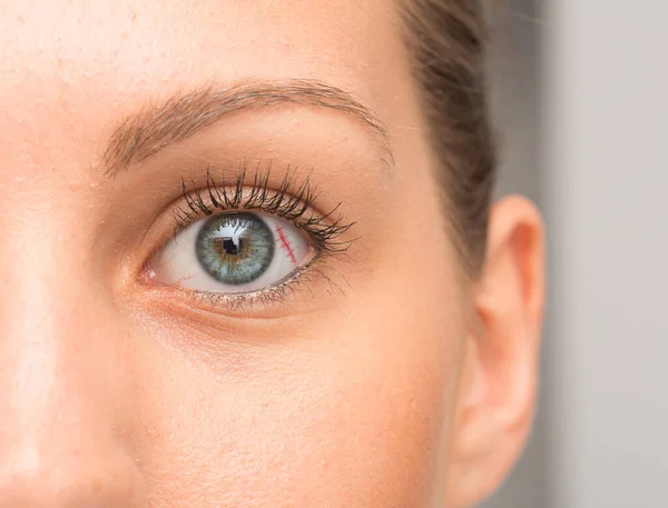 Cicatriz Esclera Uma Mulher Olho Verde — Fotografia de Stock