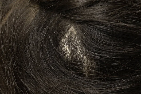 Крупним Планом Вид Жіночого Розтину Волосся — стокове фото