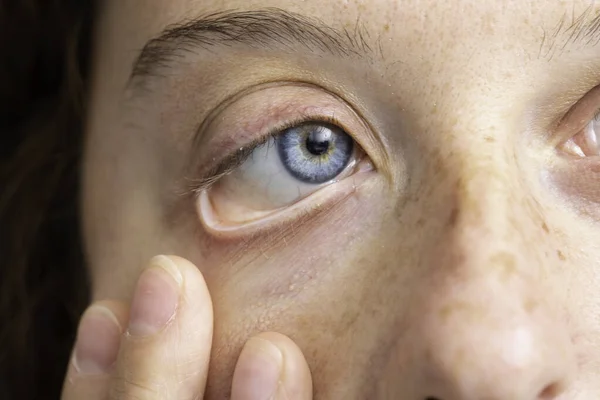 Femme Aux Yeux Bleus Montrant Globe Oculaire Près — Photo