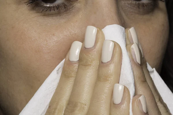 Junges Mädchen Pustet Nase Frau Hat Allergie — Stockfoto
