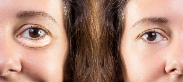 Half Face Smiling Lady Showing Age Signs — Stock Photo, Image