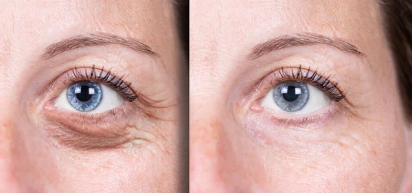 Effects Rejuvenating Treatment Women Mature Skin — Stock Photo, Image
