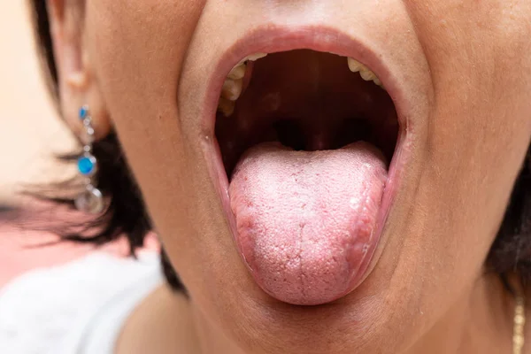 Uma Vista Perto Extrema Sobre Boca Aberta Uma Mulher Mais — Fotografia de Stock