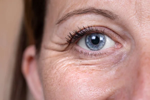 Una Vista Cercana Frontal Sobre Ojo Azul Una Mujer Caucásica —  Fotos de Stock