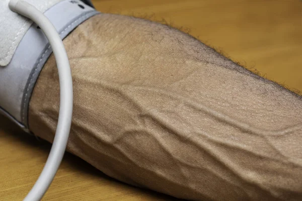 A closeup view on the bulging veins in the arm of a man as he undergoes a health checkup at the doctor\'s surgery, a blood pressure meter is wrapped around the upper arm.
