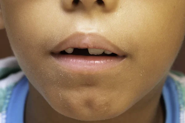 Joven Lindo Detalle Oficina Del Dentista Chequeo Oral Dientes Delanteros — Foto de Stock
