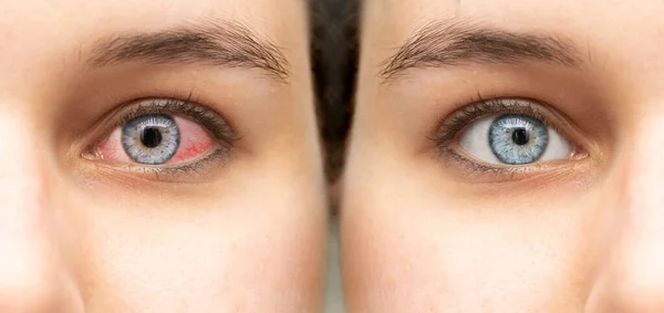 Antes Depois Vista Uma Bela Menina Caucasiana Que Estava Sofrendo — Fotografia de Stock