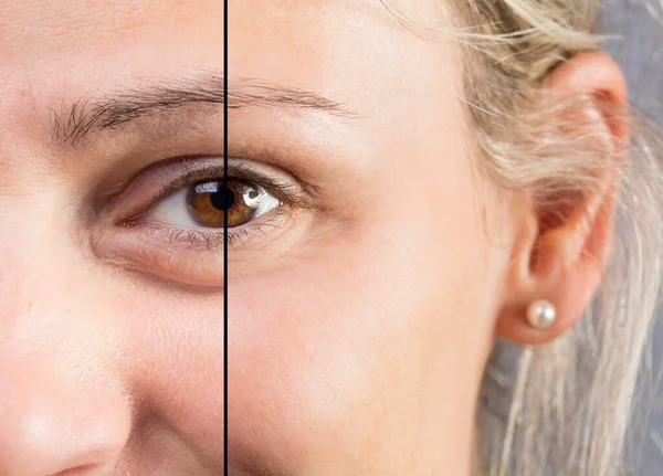 Blondynka Kaukaska Kobieta Zbliżenie Pokazując Oko Przed Aes — Zdjęcie stockowe