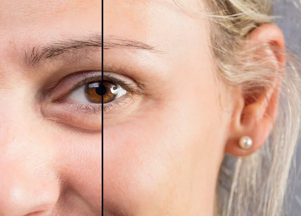 Blonde Caucasian Woman Close Showing Eye Aes — Stock Photo, Image