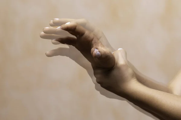 Visão Perto Mão Tremendo Uma Pessoa Que Sofre Doença Parkinson — Fotografia de Stock