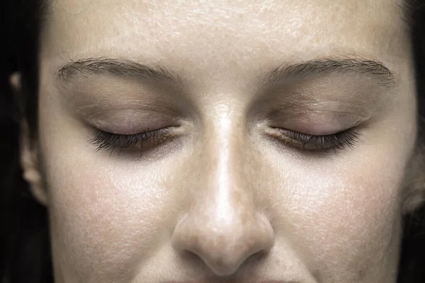 Young Woman Viewed Close She Closes Her Eyelids Revealing Swelling — Stock Photo, Image