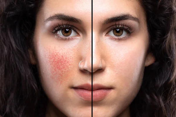 Extreme Close Portrait Beautiful Caucasian Girl Her Early Twenties Showing — Stock Photo, Image