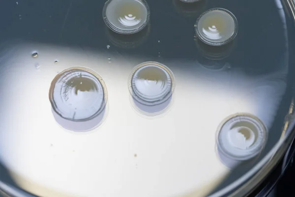 科学研究室内の寒天皿の中で培養された微生物のマクロな視点 科学の概念 — ストック写真