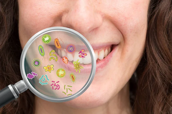 Lupa Mostrando Possível Conjunto Bactérias Cavit Oral — Fotografia de Stock