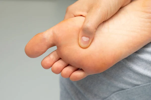 Close View Person Rubbing Massaging Sole Barefoot Toes Achy Tired — Stock Photo, Image