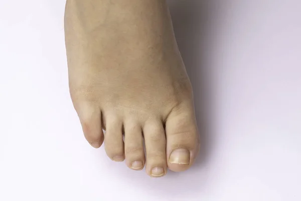 An extreme closeup and top view on the naked foot of a caucasian person, isolated against a clean white background, details of the toes and toe nails.