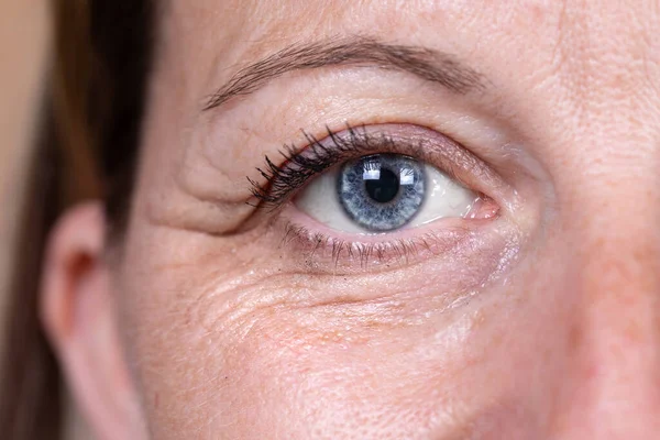 Close Vista Frontal Área Dos Olhos Uma Senhora Anos Pesados — Fotografia de Stock