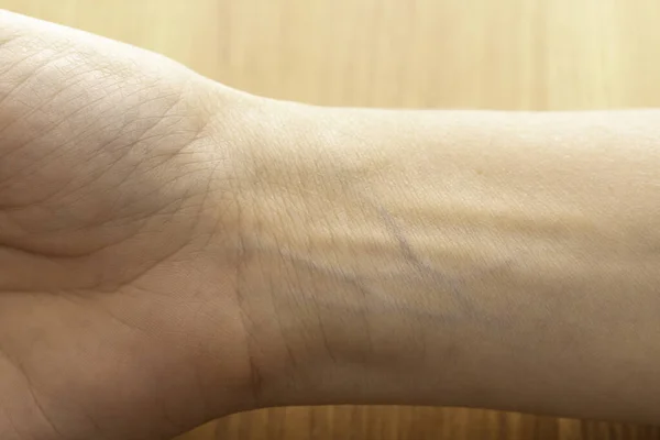 Human wrist with blue veins visible through skin close up