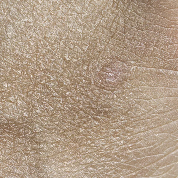 Macro of a piece of dry skin