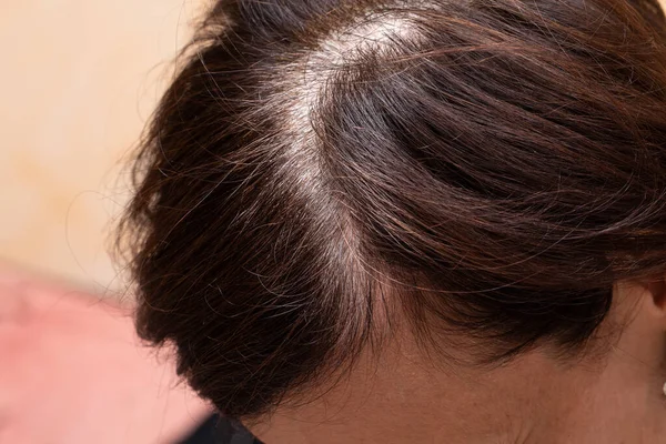 Une Vue Rapprochée Sur Coupe Cheveux Brune Une Femme Mûre — Photo