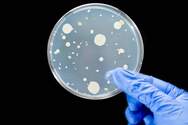 黒い背景に対して隔離された細菌の臨床サンプルを保持する医師の手 健康医学研究の概念 — ストック写真