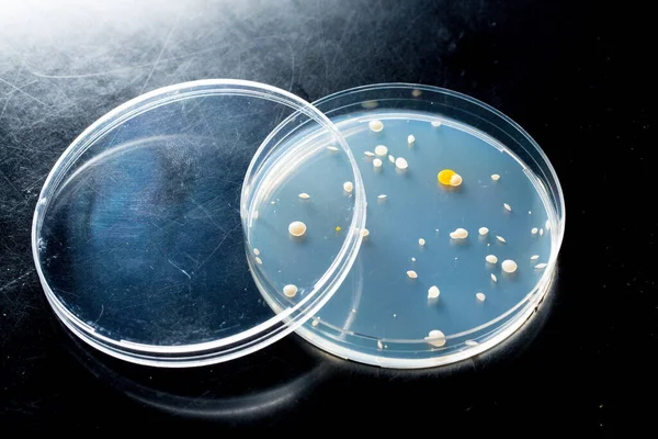 在药物研究机构的琼脂培养皿中培养的临床细菌样本的特写 — 图库照片