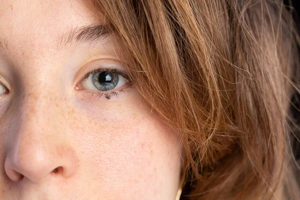 Close Blue Eye Hair Freckles White Girl — Stock Photo, Image