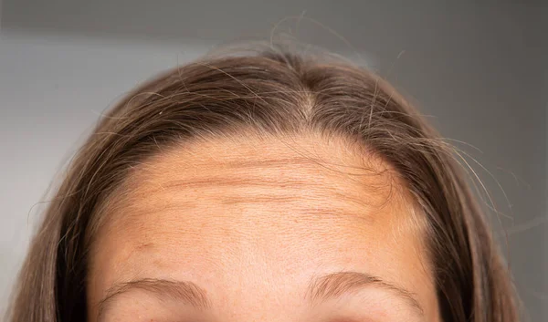 Detailní Pohled Čelo Vlasy Mladé Bělošky Světle Hnědými Vlasy Opálenou — Stock fotografie