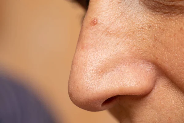 A closeup and side profile view on the nose of a mature caucasian woman, macro details of the open pores, blemishes, imperfections and skin tags. Aging skin with room for copy.